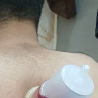 حجامت|خدمات زیبایی و سلامت|مشهد, عبادی|دیوار