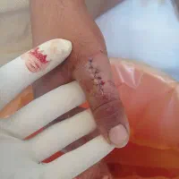 خدمات پرستاری در منزل.|خدمات آرایشگری و زیبایی|نجف‌آباد, هفده شهریور|دیوار