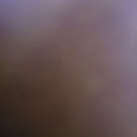 اسکان موقت
