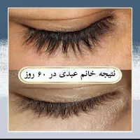 مژه ها و ابروهات رو تقویت و زیبا کن|خدمات آرایشگری و زیبایی|شیراز, ارم|دیوار