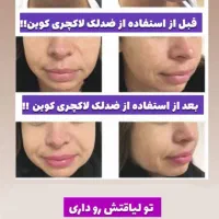 نماینده ضدلک لاکچری کوین اصل (باارسال رایگان)|آرایشی، بهداشتی، درمانی|مشهد, رضاشهر|دیوار