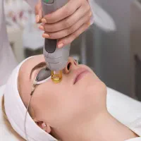 لیزر موی زائد