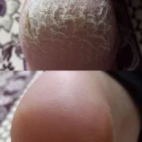 محصولات|آرایشی، بهداشتی، درمانی|جوانرود, |دیوار