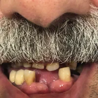 ساخت پروتز مصنوعی|پزشکی|آمل, |دیوار