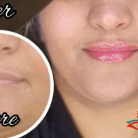 تخفیف ویژه خدمات پوست و مو به مناسبت روز  پزشک|خدمات آرایشگری و زیبایی|کرمانشاه, |دیوار