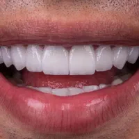 دندانپزشکی|خدمات آرایشگری و زیبایی|کوهدشت, |دیوار