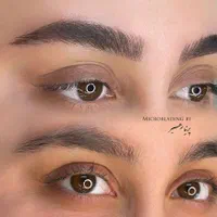 میکروبلیدینگ میکرو ابرو فیبروز ، ریمو