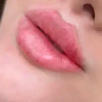 آموزش ژل و بوتاکس پی ار پی