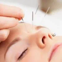 همایش طب سوزنی