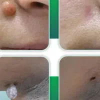 اموزش ارایشگری مردانه.کراتینه .فر.خالبرداری|خدمات آموزشی|دزفول, |دیوار