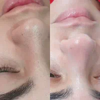 خدمات پاکسازی پوست فیشیال