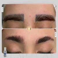 ریمو تتو با تضمین سلامت پوست