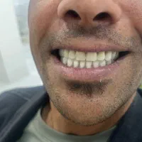 کلینیک دندانسازی ‌مروارید۴۰٪ افر ب مدت ۲۰ روز