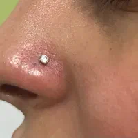 اف ویژه زیبایی تزریق ژل، بوتاکس، پی ار پی|خدمات آرایشگری و زیبایی|اهواز, کمپلو جنوبی|دیوار
