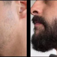 قطعا ریش نشونه مردونگیه