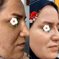 کرم ۱۰ کاره ویتامین سی