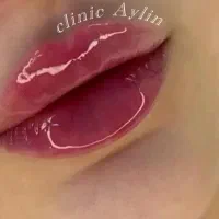 ژل لب فیلر بوتاکس مزو جوانسازی کانتوریگ لیفت نخ|خدمات آرایشگری و زیبایی|تهران, پونک|دیوار