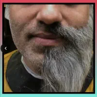 کف دستتم بزنی مو در میاد