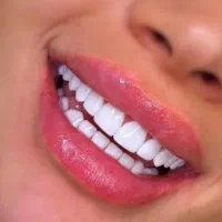 کامپوزیت دندان  تخصصی