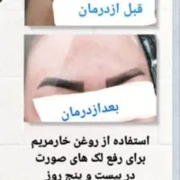 روغن درمانی|خوردنی و آشامیدنی|اسلامشهر, ده عباس|دیوار