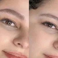 میکروبلیدینگ تخفیف ویژه مدل رایگان