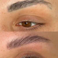 ریموو(پاکی)تاتوصورت وبدن خانم آقاودرمان کبودی لب