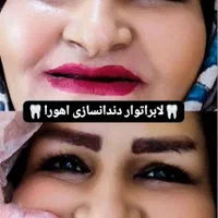 دندان ،دندان سازی ،دندان مصنوعی ،جوان پسند،اقساطی|خدمات آرایشگری و زیبایی|مشهد, شاهد (شهرک غرب)|دیوار