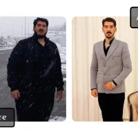 مرکز تخصصی جراحی چاقی اسلیو و بای‌پس