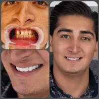 دندانپزشکی دیجیتال نقدواقساط بدون کارمزدبا۲۰%تخفیف|خدمات آرایشگری و زیبایی|مشهد, سناباد|دیوار