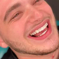 دندانپزشکی/لمینیت/کامپوزیت/جراحی دندان/ایمپلنت