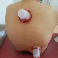 حجامت|خدمات آرایشگری و زیبایی|قرچک, مهدیه|دیوار