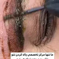 تخفیفات یلدایی ریموو تاتو /آرایش دائم|خدمات آرایشگری و زیبایی|سمنان, |دیوار