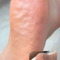 جشنواره خدمات و آموزش کفسابی و پارافین تراپی|خدمات آرایشگری و زیبایی|اصفهان, خانه اصفهان|دیوار