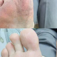 پدیکور  حرفه ای در مهاباد|خدمات آرایشگری و زیبایی|مهاباد (آذربایجان غربی), |دیوار