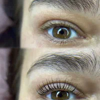 اصلاح صورت تخصصی اپلاسیون تخصصی با سابقه کاری بالا