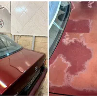 رفع آفتاب سوختگی بدون رنگ