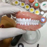 پروتز متحرک دندان