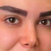 مدل کاشت ابرو (فقط هزینه اتاق عمل)