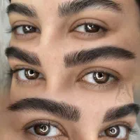 مدل برای فیبروز ابرو