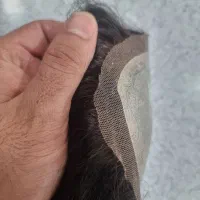 پروتز مو انکارایی|آرایشی، بهداشتی، درمانی|تهران, سیمای ایران|دیوار