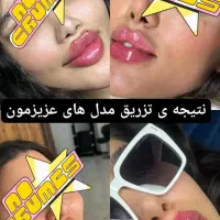 بازم مدل میخوایم