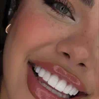 ایمپلنت دیجیتال بدون پرداخت حتی 1 ریال