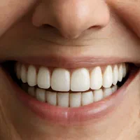 ساخت دندان مصنوعی با بیمه تامین اجتماعی***