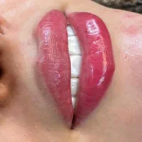 کلینیک لیزر  پوست و مو الیزا|خدمات آرایشگری و زیبایی|ری, اقدسیه|دیوار