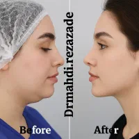 فیلر بوتاکس لیزر فیلربادی لاغری مزوتراپی prp جراحی|خدمات آرایشگری و زیبایی|مشهد, هنرستان|دیوار