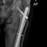 رادیولوژی و سونوگرافی در منزل تهران و کرج|پزشکی|تهران, ونک|دیوار
