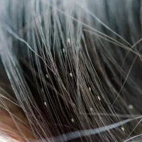 پاکسازی تخصصی شپش زیر نظر استاد حرفه ای|خدمات آرایشگری و زیبایی|قم, شاه ابراهیم|دیوار