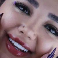 کامپوزیت/لمینت/ایمپلنت/روکش