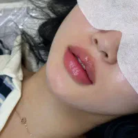 کلینیک تزریق فیلر مزو بوتاکس لیزر جوانساز پوست