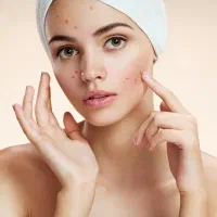 کربن پیلینگ و کربوکسی|خدمات آرایشگری و زیبایی|کرج, مهرویلا جنوبی|دیوار